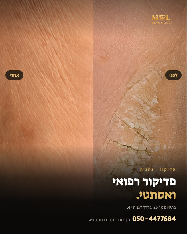 מודעת פיד למכון יופי: פדיקור רפואי ואסתטי, לפני ואחרי